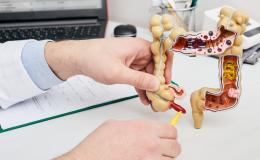 Model jelita grubego w rekach lekarza